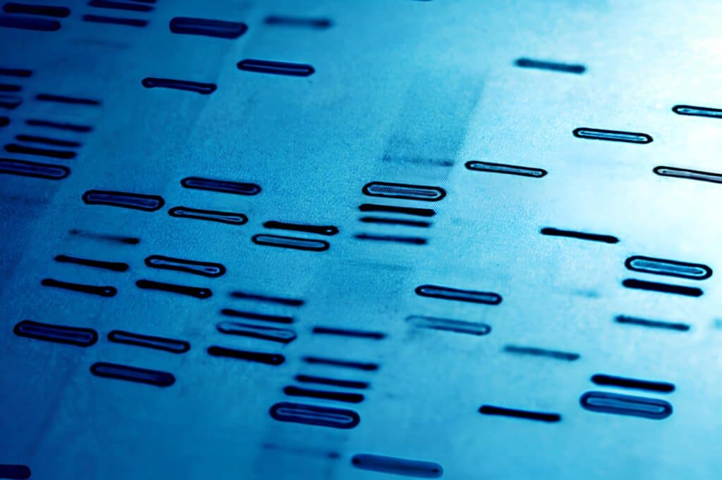 dépistage trisomie 21 sage femme benedicte paturel