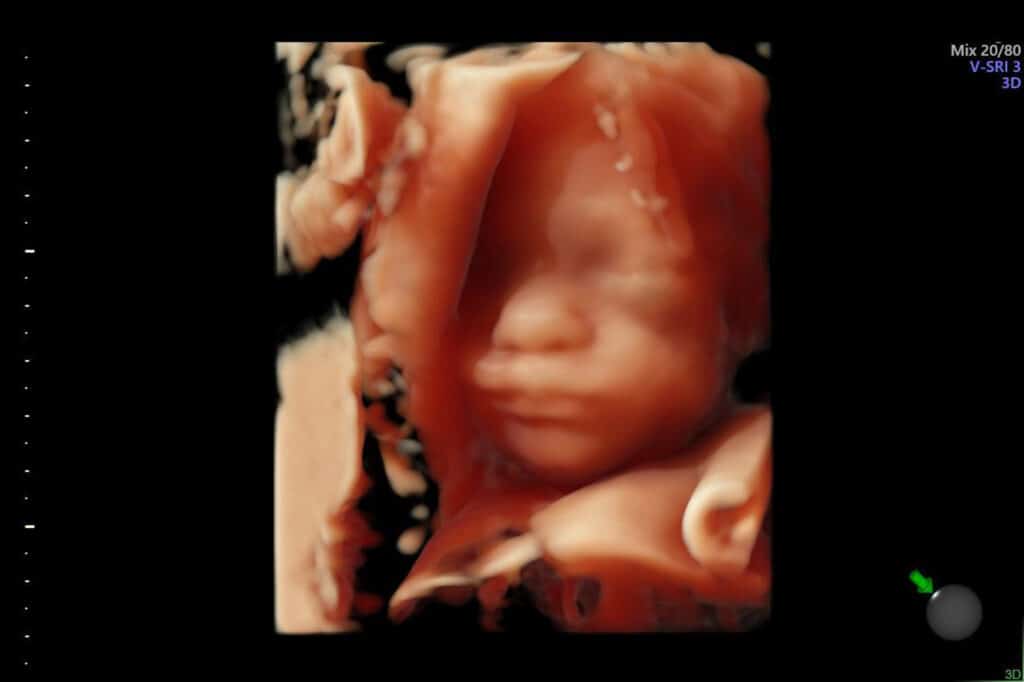 échographie sage femme bonneville