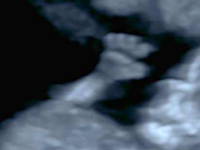 échographie sage femme bonneville