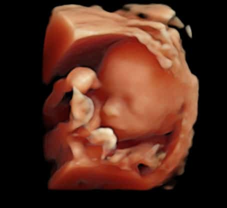 échographie sage femme bonneville