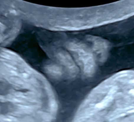 échographie sage femme bonneville