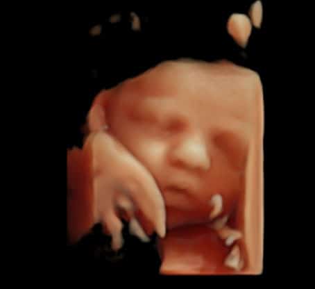 échographie sage femme bonneville