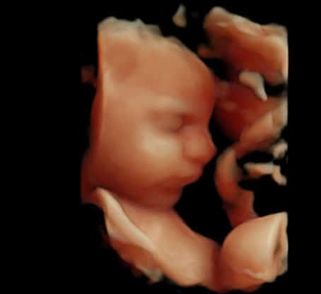 échographie sage femme bonneville