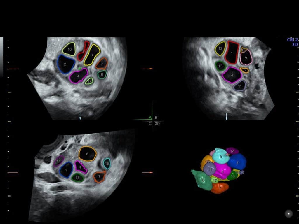échographie sage femme bonneville